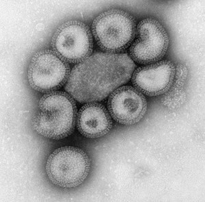 Viruses seen through the of a electron microscope